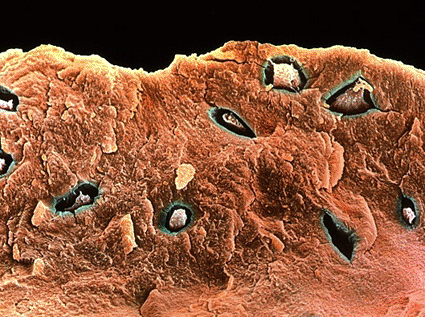 Imagen: Microfotografía electrónica de barrido (SEM) a color de células osteoblásticas formadoras de hueso (óvalos irregulares) rodeadas por la matriz ósea que han creado (Foto cortesía de Steve Gschmeissner / SPL).